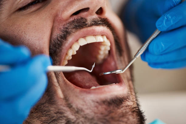 Best Same-Day Emergency Dentist in Whiteman Af, MO