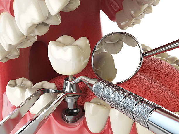 Best Urgent Dental Care in Whiteman Af, MO